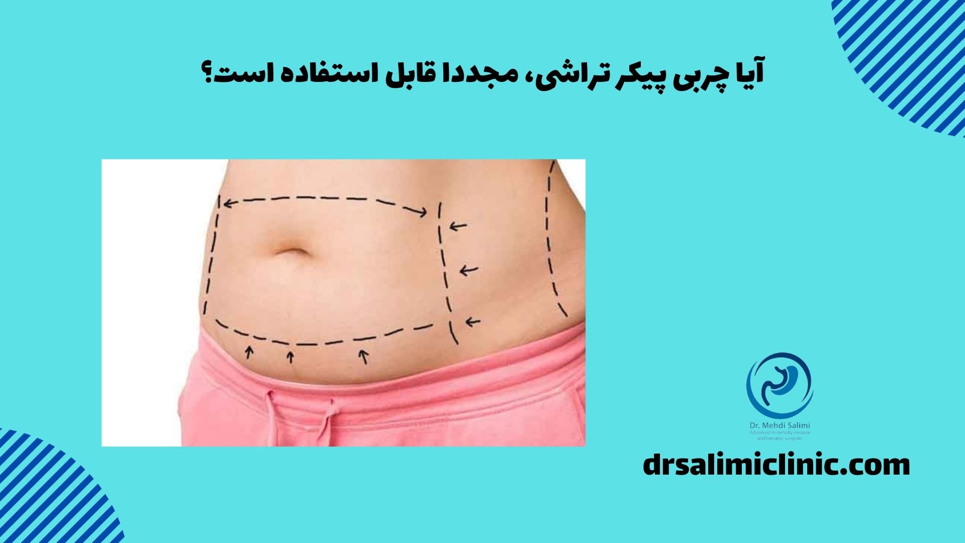 آیا چربی پیکر تراشی، مجددا قابل استفاده است؟