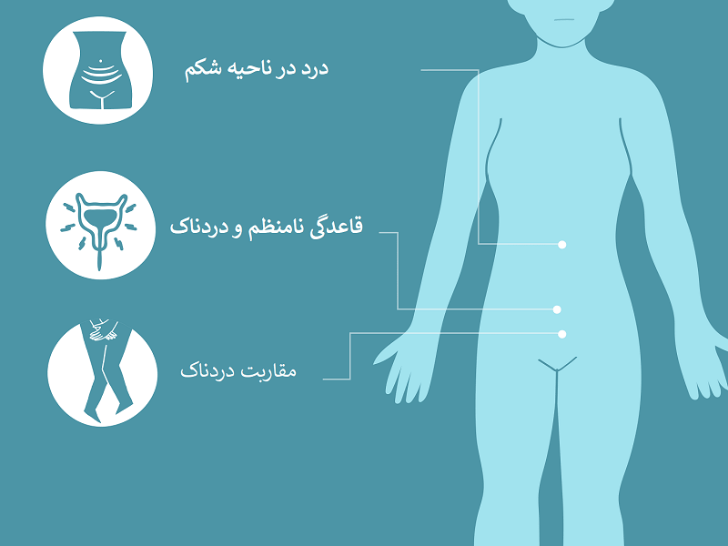 اختلال در تخمک‌گذاری