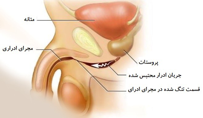 آزمایش اوره ادرار 24 ساعته و راندوم