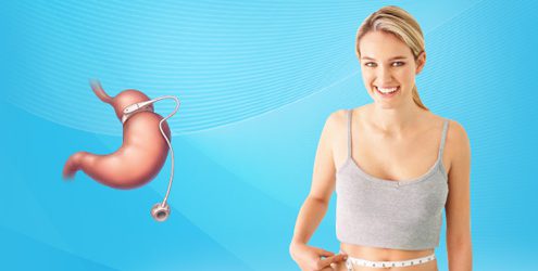 تصویر آرشیوی مقاله حلقه معده؛ اگر قبلاً باندینگ کردهاید چه پیگیری لازم است؟