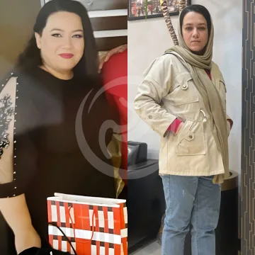 تصویر مقایسه‌ای از آرشیو کلینیک؛ شماره 2