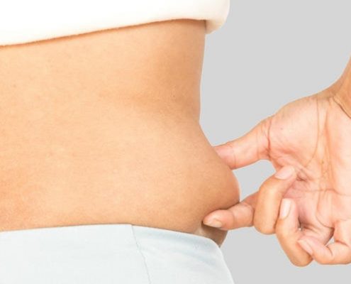 عمل جراحی اسلیو معده چیست؟