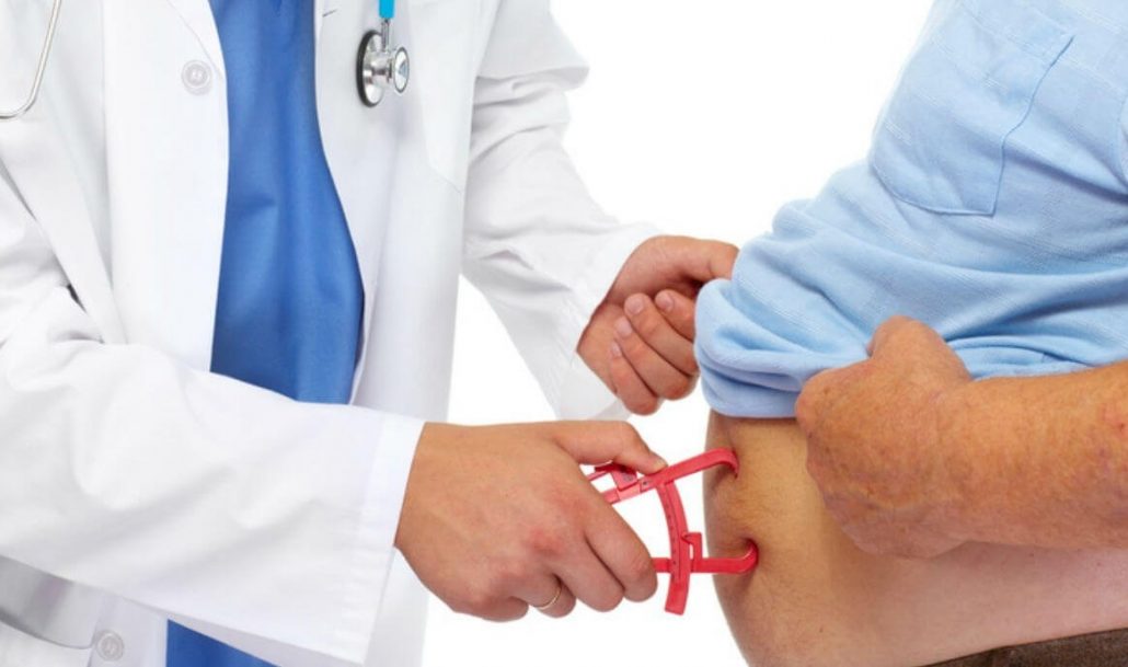 جراحی چاقی و دیابت
