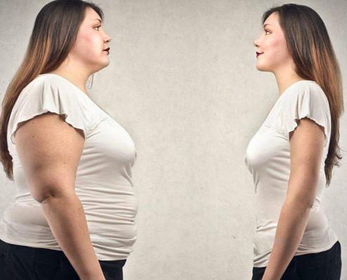 میزان کاهش وزن بعد از جراحی بای پس معده در افراد مختلف با هم فرق دارد