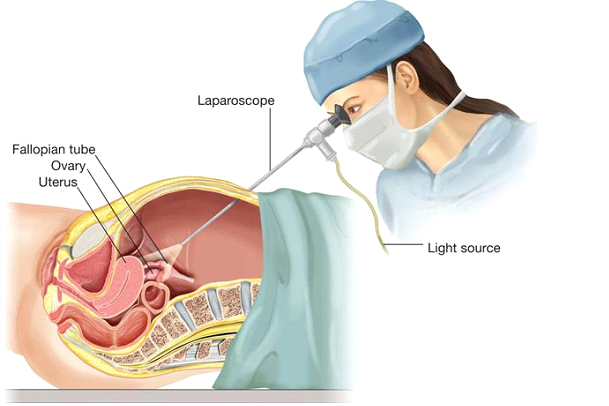 عملکرد جراحی چاقی لاپاراسکوپی