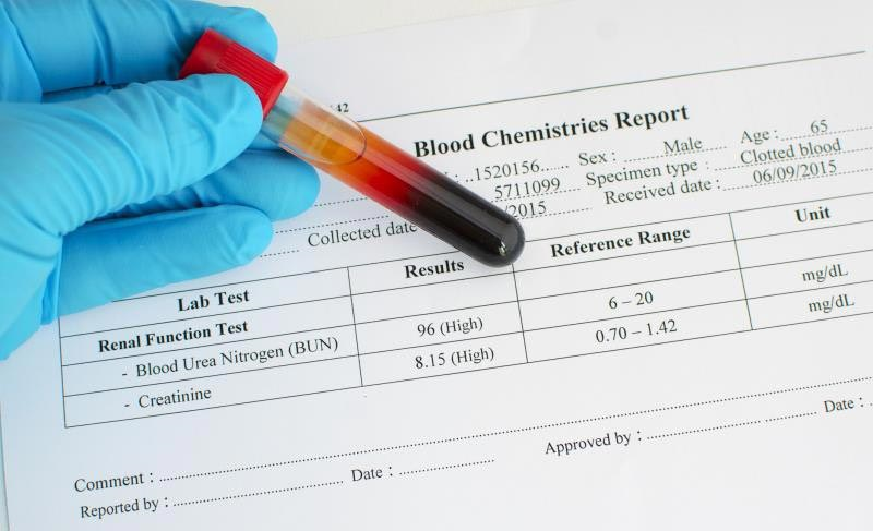 نتایج آزمایش هموگلوبین A1C