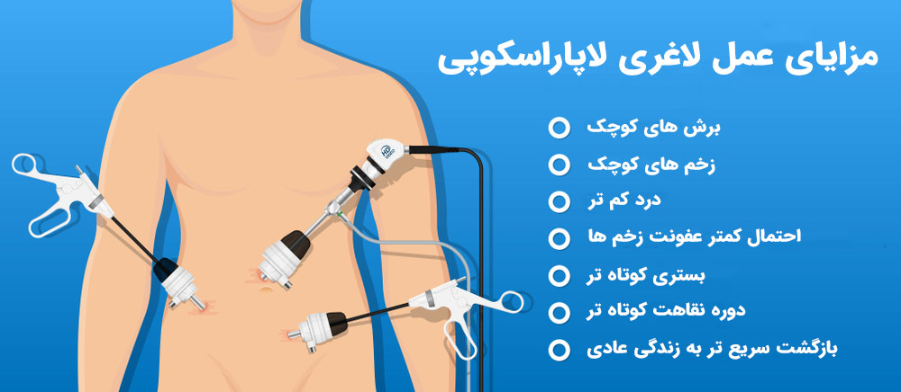 مزایای جراحی لاپاراسکوپی چیست