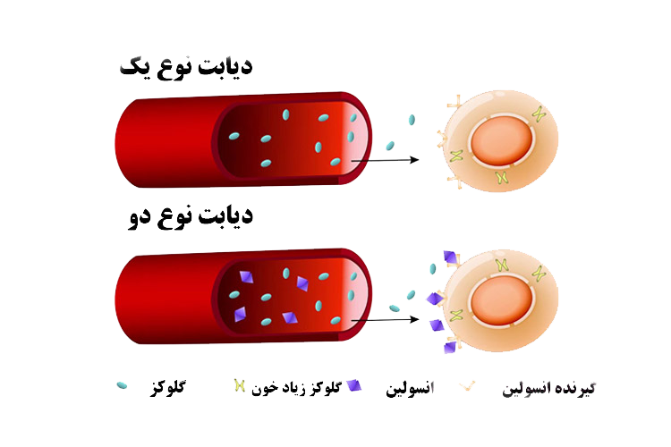 علائم و نشانه‌های دیگر برای شناخت دیابت نوع ۱