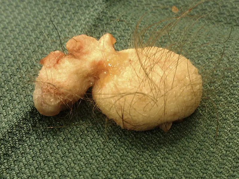 سلول های بنیادی (Stem Cells)