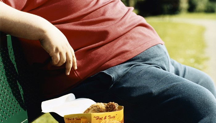BMI بالاتر از 40