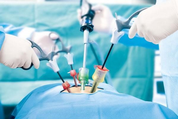 مزایای عمل جراحی اسلیو معده چیست؟