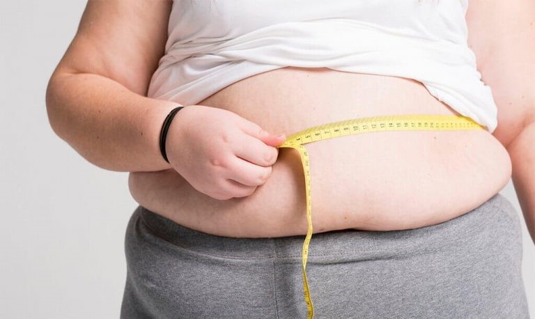 بسیاری از افراد، انتظار دارند که پس از انجام عمل جراحی چاقی، به صورت معجزه آسایی تمامی وزن اضافی بدن ایشان در مدتی کوتاه از بین برود