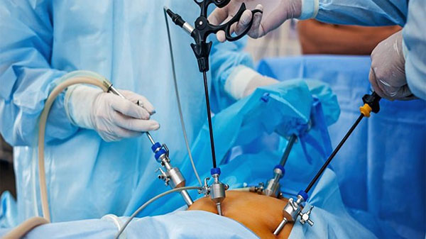 جراحی چاقی می تواند به عنوان یک روش تضمینی و صددرصدی مورد استفاده قرار گیرد