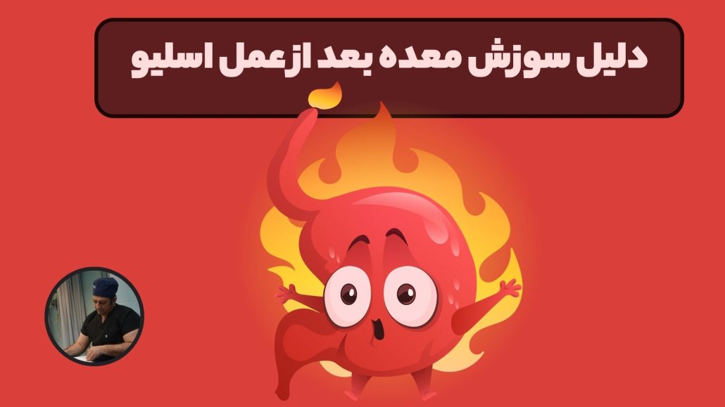 دلیل سوزش معده بعد از عمل اسلیو