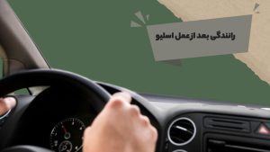 رانندگی بعد از عمل اسلیو