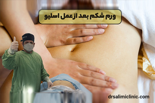 ورم شکم بعد از عمل اسلیو معده - drsalimiclinic.com