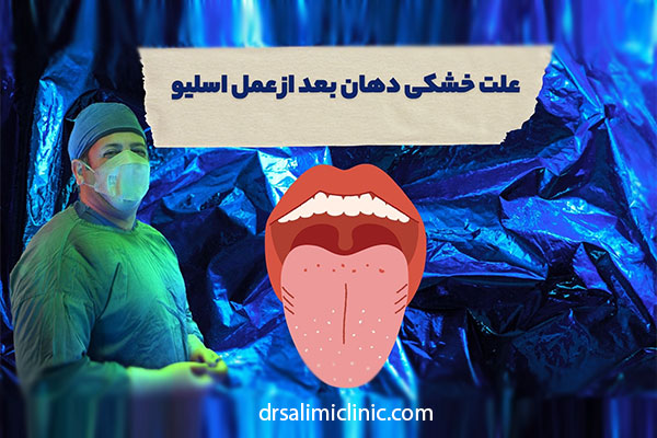 علت خشکی دهان بعد از عمل اسلیو - drsalimiclinic.com