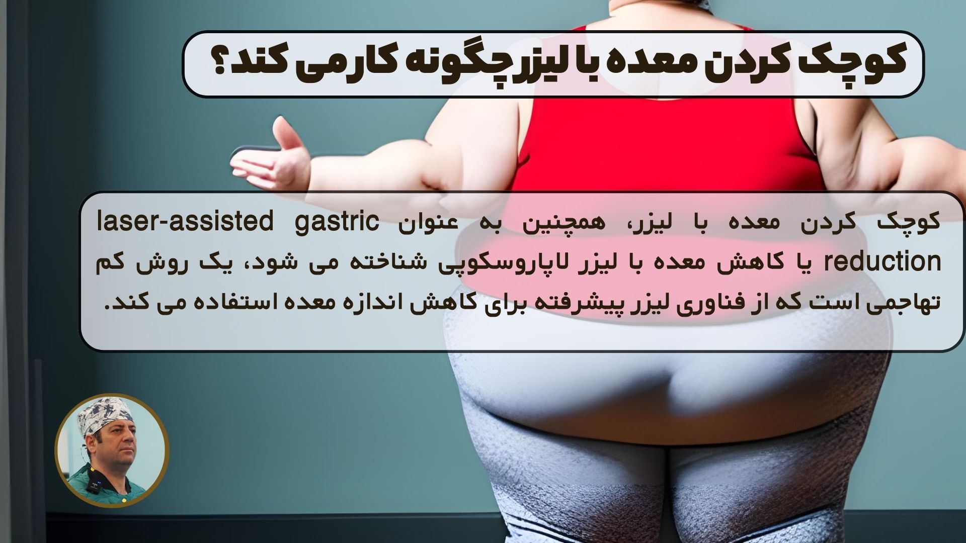 کوچک کردن معده با لیزر چگونه کار می کند؟