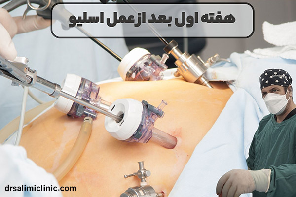 هفته اول بعد از عمل اسلیو معده - drsalimiclinic.com