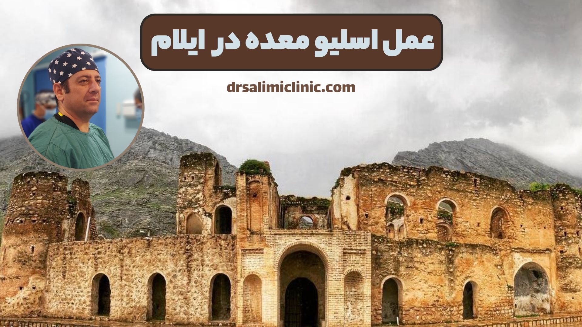 عمل اسلیو معده در ایلام