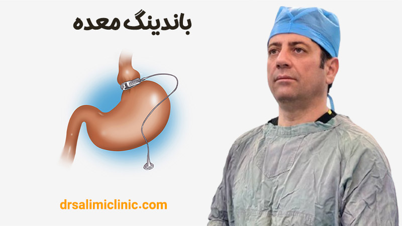 باندینگ معده - drsalimiclinic.com