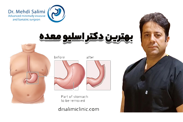 بهترین دکتر اسلیو معده - drsalimiclinic.com