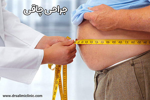 جراحی چاقی با دکتر سلیمی - drsalimiclinic.com