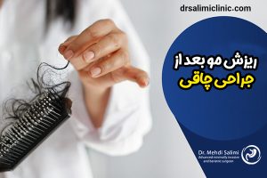 ریزش مو بعد از جراحی چاقی -drsalimiclinic.com