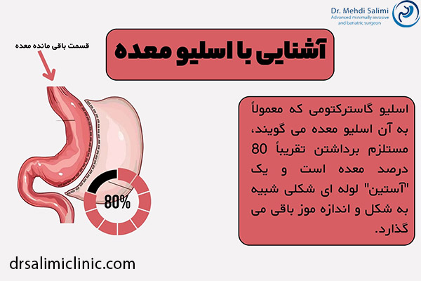 عمل اسلیو معده چیست