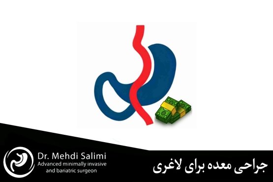 هزینه جراحی چاقی