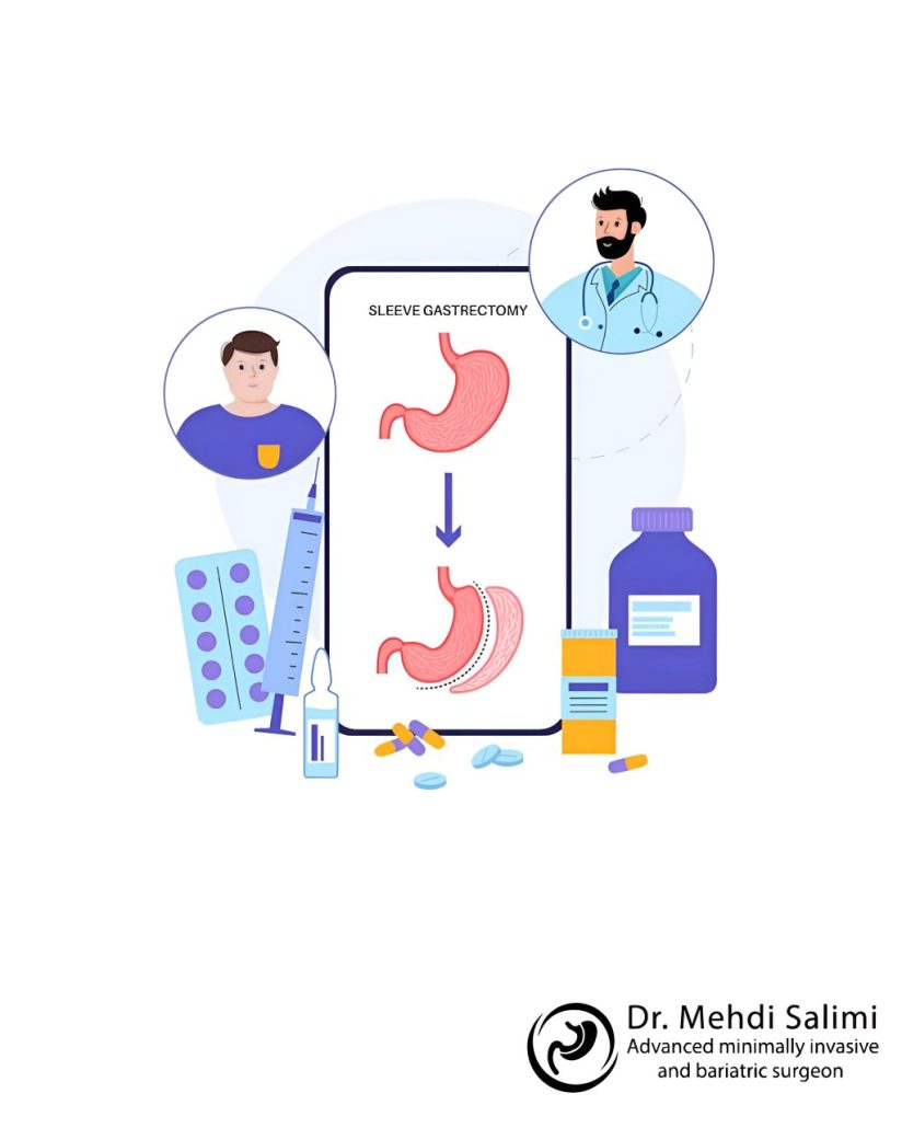 درباره کاهش وزن بعد از عمل اسلیو معده