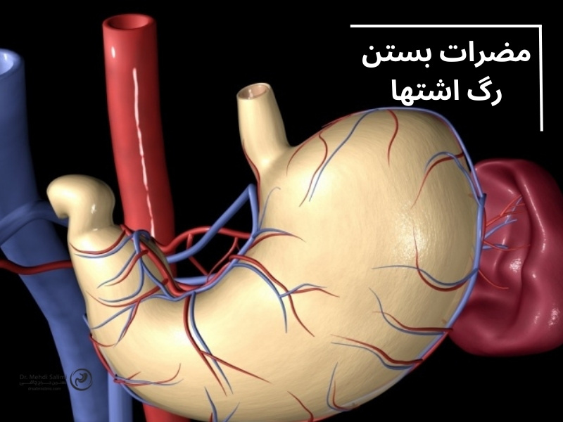 بستن رگ اشتها