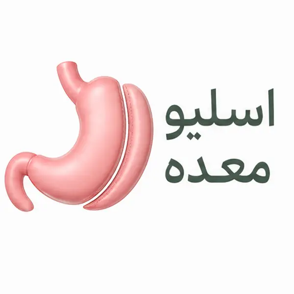 اسلیو معده