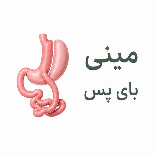 مینی بای پس