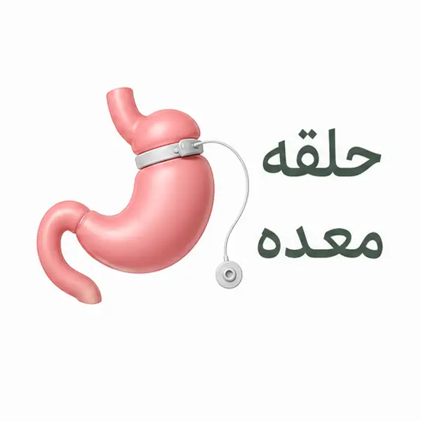 حلقه معده
