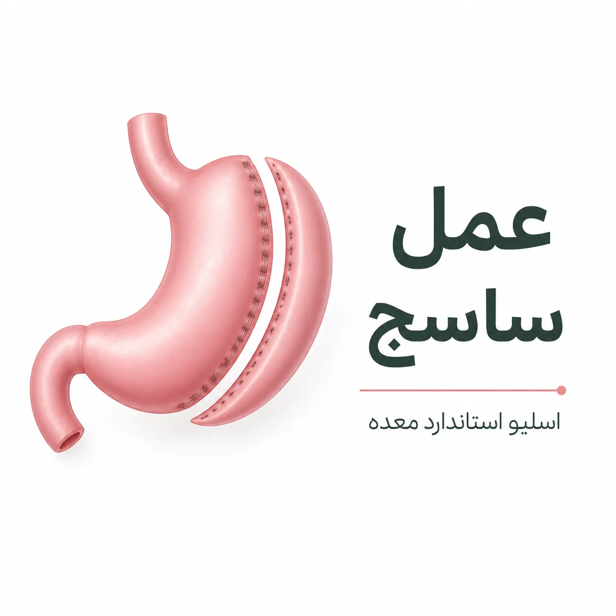عمل ساسج